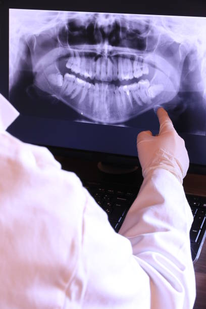 Best Broken or Cracked Tooth Emergency Dentist in Moreno Valley, CA